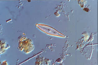 9 - Gomphonema angustatum