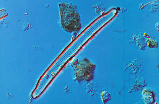 10 - Eunotia pectinalis